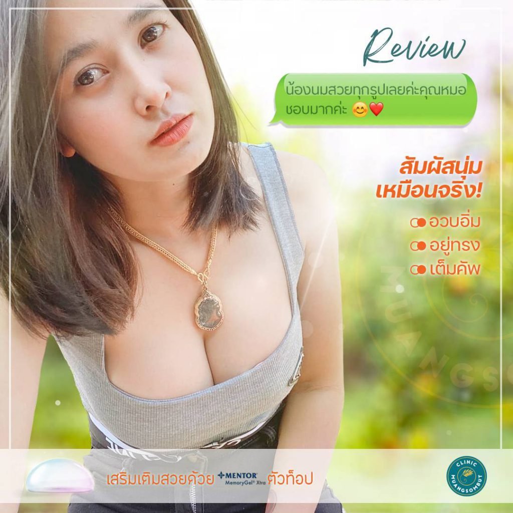 เสริมหน้าอกหาดใหญ่