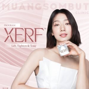 PROGRAM XERFS__15523844